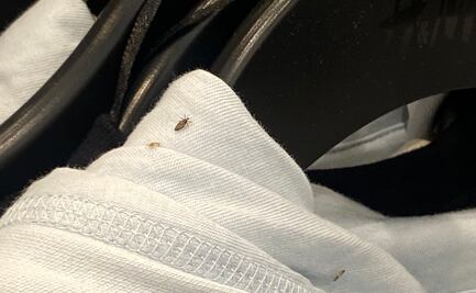 Trabajadora denuncia presencia de piojos en tienda de ropa en NY