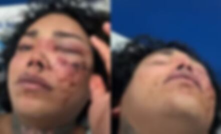 Tras comprometerse, Paola Suárez de ‘Las Perdidas’ sufre brutal golpiza por parte de su novio