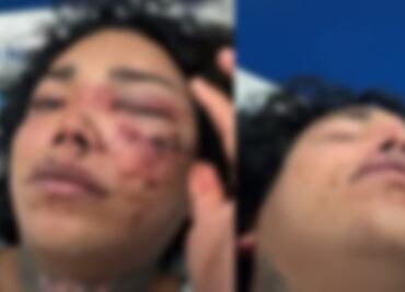 Tras comprometerse, Paola Suárez de ‘Las Perdidas’ sufre brutal golpiza por parte de su novio