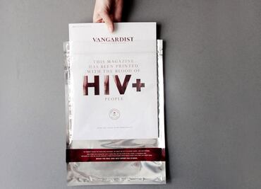 Descubren nueva variante más virulenta y transmisible del VIH