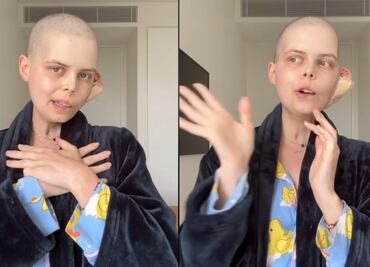 Muere famosa influencer a los 24 años por extraña enfermedad; video de despedida se viraliza