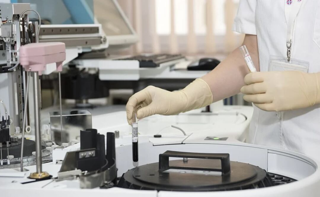 Alerta la OMS: Gripe aviar en gatos podría requerir vacunas para evitar propagación a humano. Foto PIXABAY