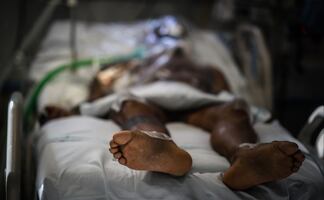 “Hongo negro” llega a Uruguay; infecta a paciente recuperado de Covid