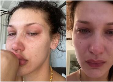“Las redes sociales no son reales”, Bella Hadid padece depresión y ansiedad