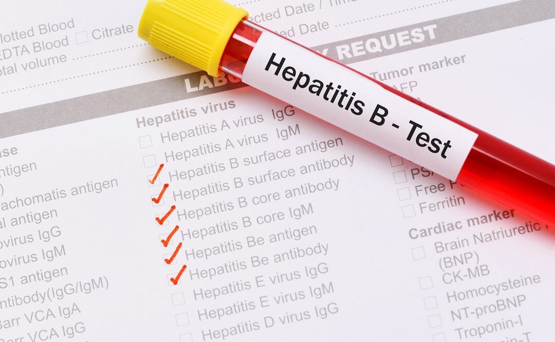 Aumentan los casos de hepatitis B en vecindarios pobres de Nueva York, principalmente. Foto: iStock-jarun011