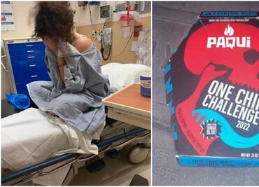Alertan en EU por reto con totopos picantes que está enviando a jóvenes al hospital