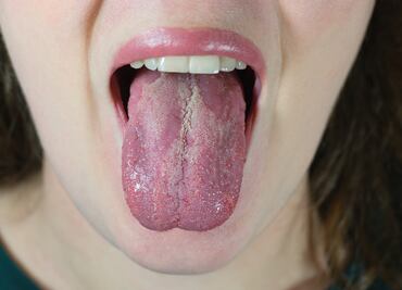 Lo que el color de tu lengua dice sobre tu salud, según Harvard