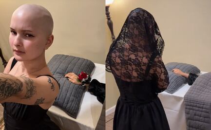 Influencer con cáncer hace un funeral para su brazo amputado: “Es una experiencia bellamente catártica”. VIDEO