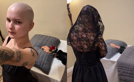 Influencer con cáncer hace un funeral para su brazo amputado: “Es una experiencia bellamente catártica”. VIDEO