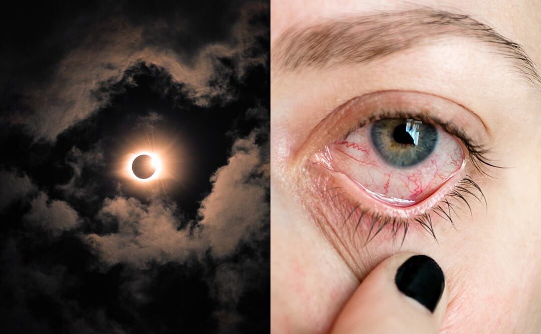 Daño ocular por eclipse solar. Foto: iStock/ Wirestock/ shutnica