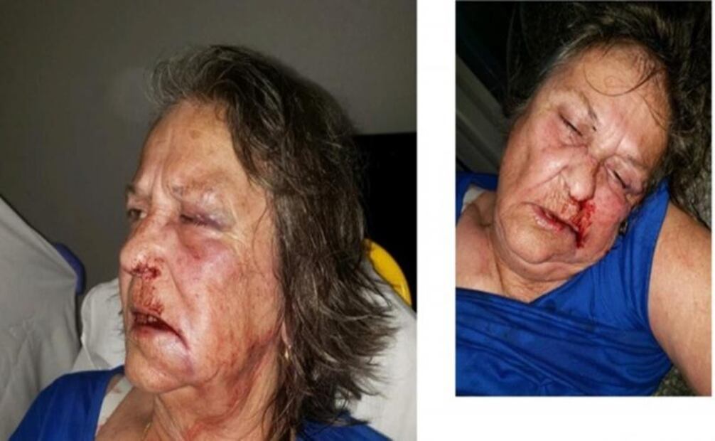 Mujer fractura cráneo a activista que trataba de ayudarla en Texas