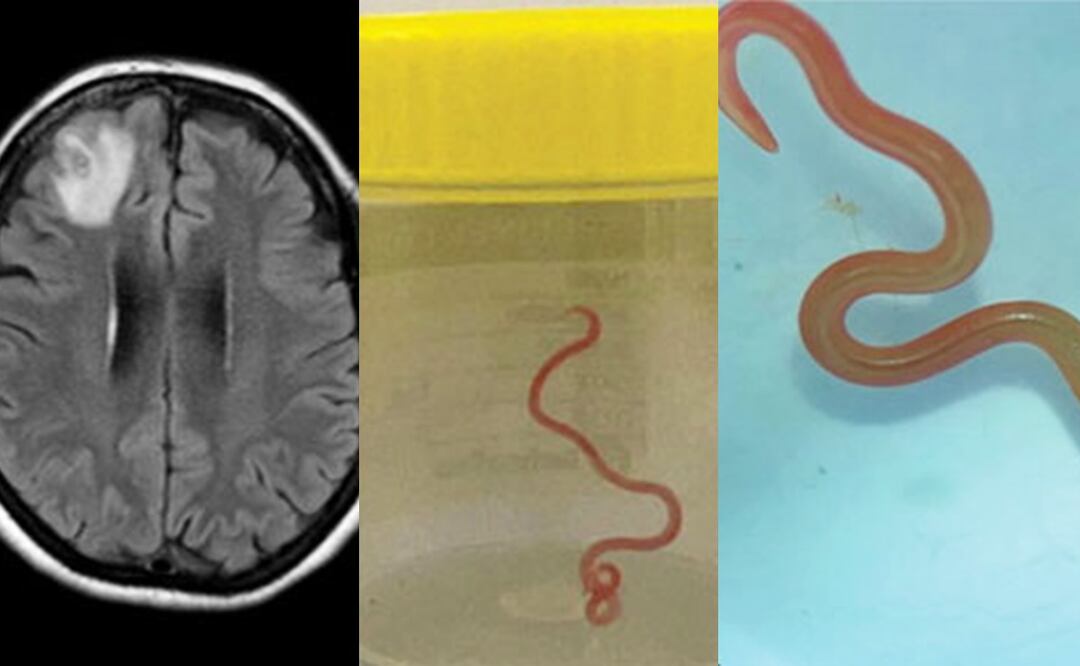 Ophidascaris robertsi/EFE