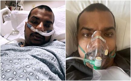 Hombre que se burló de las vacunas muere por Covid-19 en California