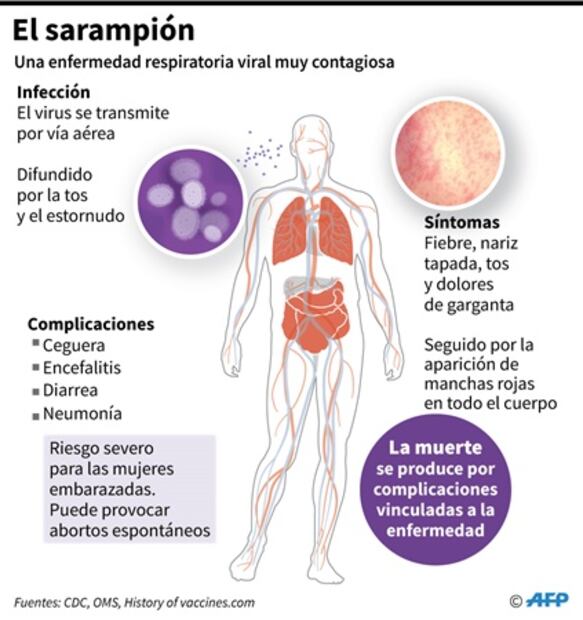 Suman más de 800 casos de sarampión en Estados Unidos