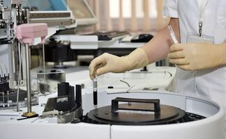 ¿Qué son las pruebas de anticuerpos contra el Covid-19?