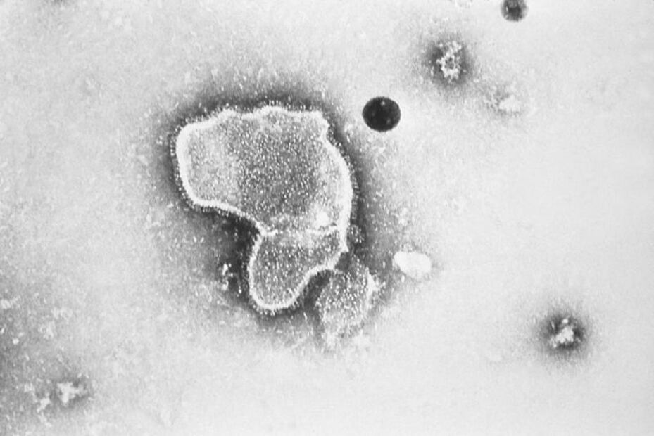 Virus sincitial respiratorio: ¿qué lo causa, cuáles son los síntomas y por qué afecta a niños?