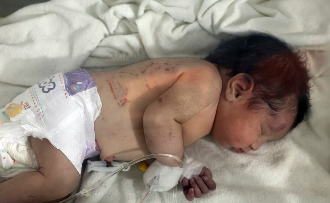 AP P¿Qué es la septicemia neonatal por enterovirus que afecta a recién nacidos en Francia? oto/Ghaith Alsayed