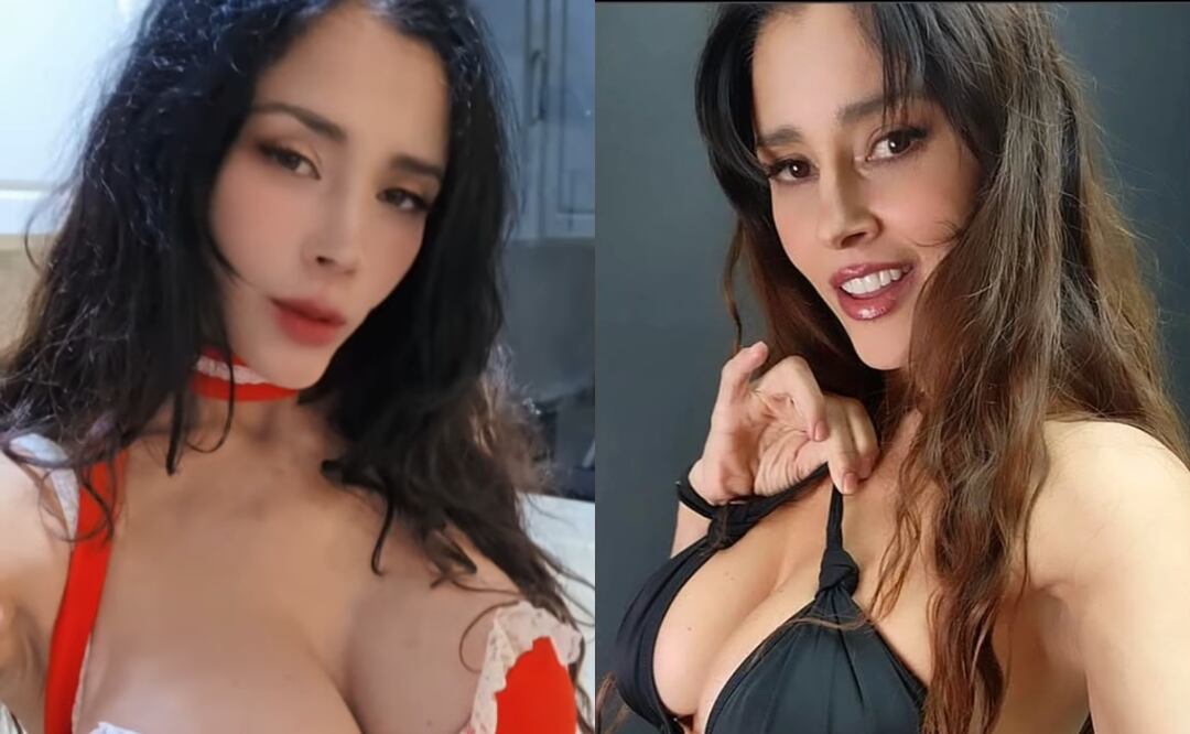 Así luce hoy Dorismar tras una cirugía estética que salió mal: “estoy en rehabilitación”. Foto: Tomada de Instagram @dorismartv