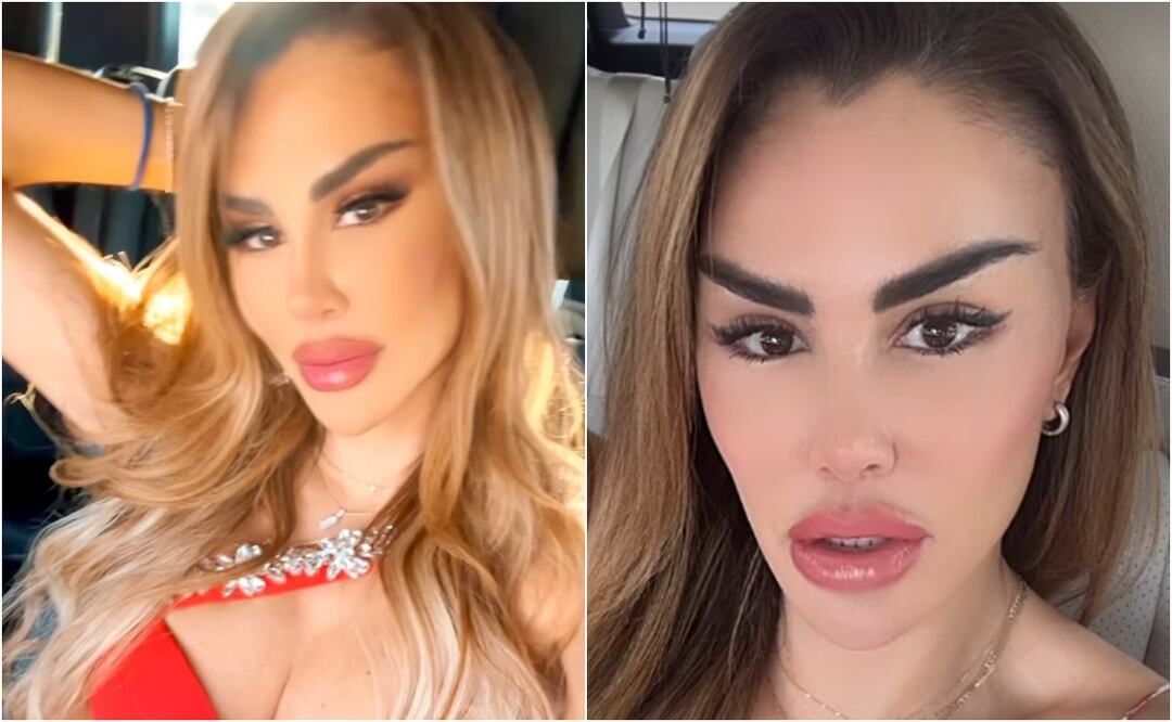¿Qué se hizo? Critican a Ninel Conde por lucir irreconocible tras múltiples cirugías plásticas. Foto: Instagram