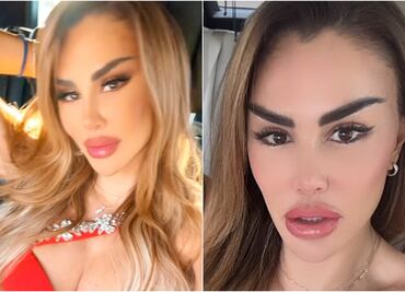 ¿Qué se hizo? Critican a Ninel Conde por lucir irreconocible tras múltiples cirugías plásticas