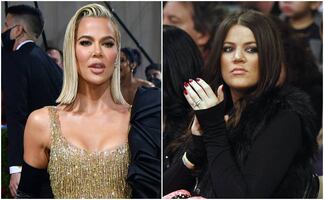 “Sólo me hice la nariz”; Khloé Kardashian niega haberse sometido a varias cirugías