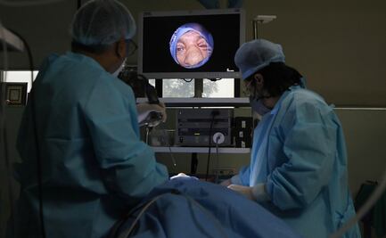 Honduras confirma primer caso de hongo negro en recuperado de covid